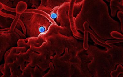¿Es delito contagiar una enfermedad de transmisión sexual?